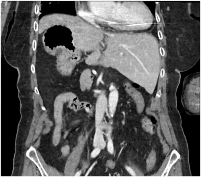 https://cdn.ncbi.nlm.nih.gov/pmc/blobs/8c72/12399160/4b4c51bff0ee/gr1.jpg