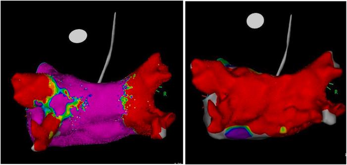 https://cdn.ncbi.nlm.nih.gov/pmc/blobs/8c72/12399160/4d9bcc54ce81/gr3.jpg