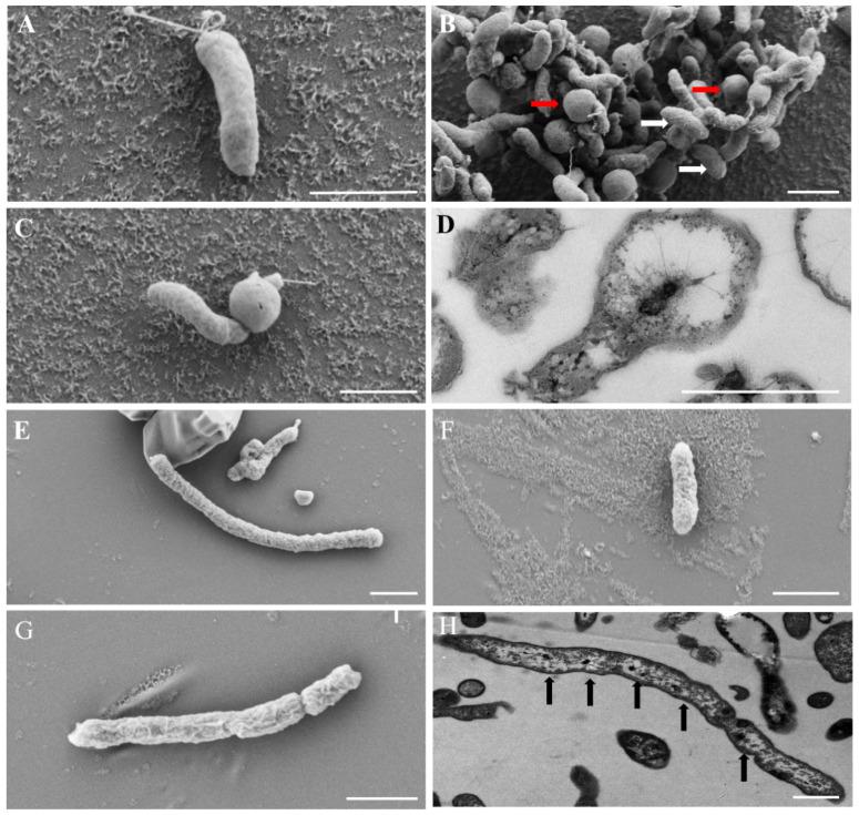 https://cdn.ncbi.nlm.nih.gov/pmc/blobs/8c78/12113678/eda6b6a5e5bb/microorganisms-13-01028-g004.jpg