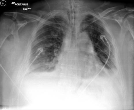 https://cdn.ncbi.nlm.nih.gov/pmc/blobs/8c7c/3201100/bb25f0eb7278/ccrep-4-2011-039f1.jpg