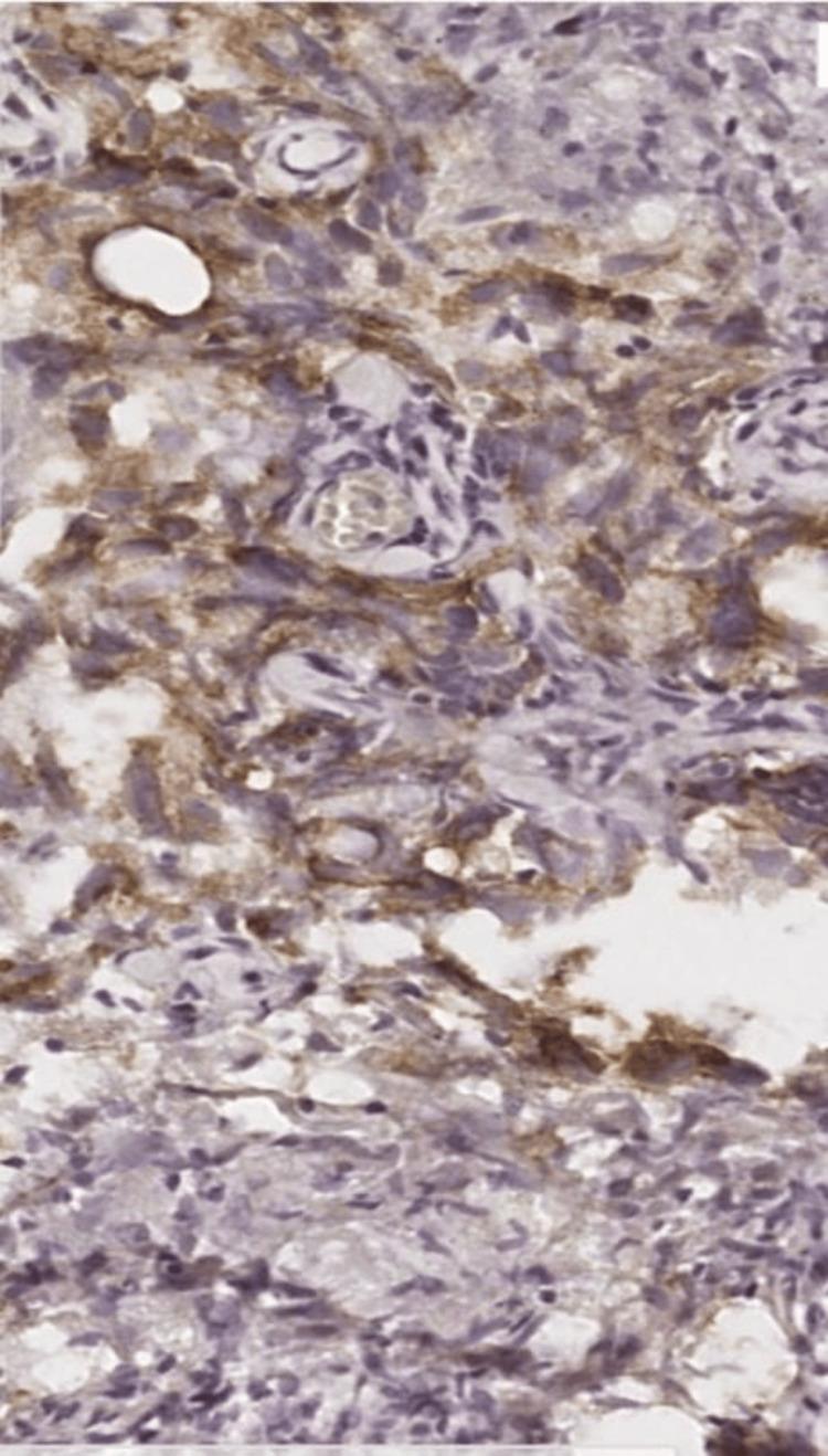 https://cdn.ncbi.nlm.nih.gov/pmc/blobs/8c7e/11066817/f69fd9811485/cureus-0016-00000057504-i03.jpg