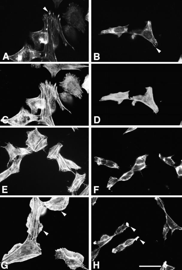 https://cdn.ncbi.nlm.nih.gov/pmc/blobs/8c82/2133183/2c86d8115a34/JCB9902071.f11.jpg
