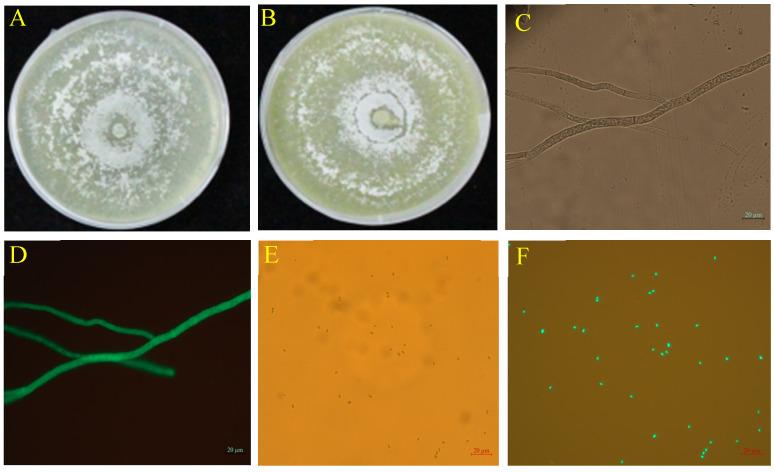 https://cdn.ncbi.nlm.nih.gov/pmc/blobs/8c86/12071606/1fab98337026/ijms-26-04018-g001.jpg