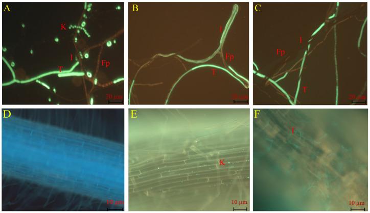 https://cdn.ncbi.nlm.nih.gov/pmc/blobs/8c86/12071606/d29806e24839/ijms-26-04018-g002.jpg