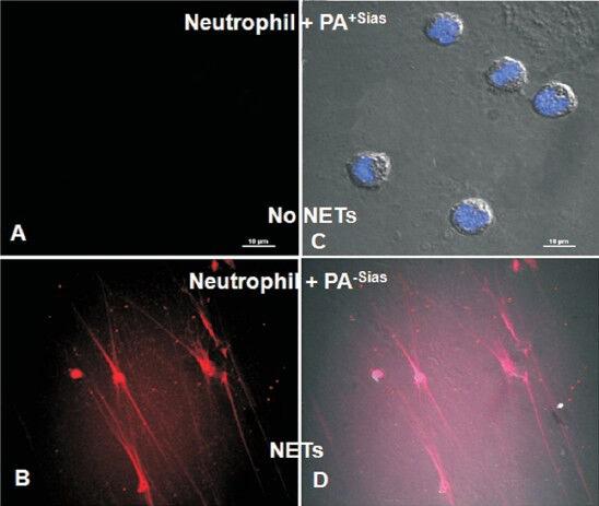 https://cdn.ncbi.nlm.nih.gov/pmc/blobs/8c8d/3928697/47c8556ed607/IJMR-138-648-g006.jpg