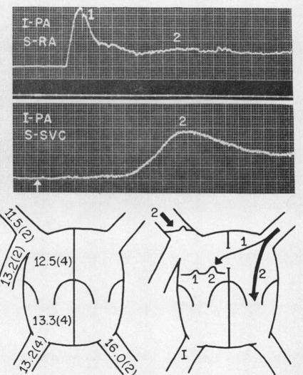 https://cdn.ncbi.nlm.nih.gov/pmc/blobs/8c94/1017800/eb9ca6bd2435/brheartj00365-0021-b.jpg