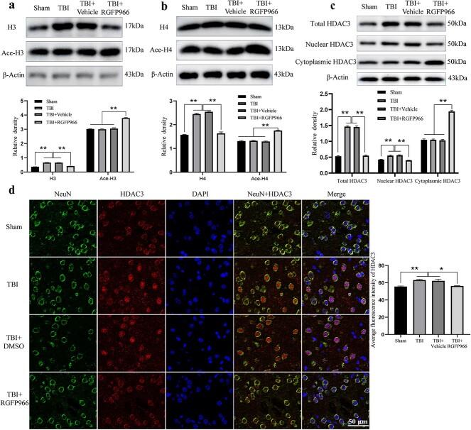 https://cdn.ncbi.nlm.nih.gov/pmc/blobs/8c98/11069425/16e8d865340f/tkad062f5.jpg
