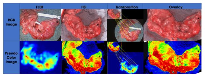 https://cdn.ncbi.nlm.nih.gov/pmc/blobs/8c9a/7602144/02f02b345a0c/cancers-12-02977-g007.jpg