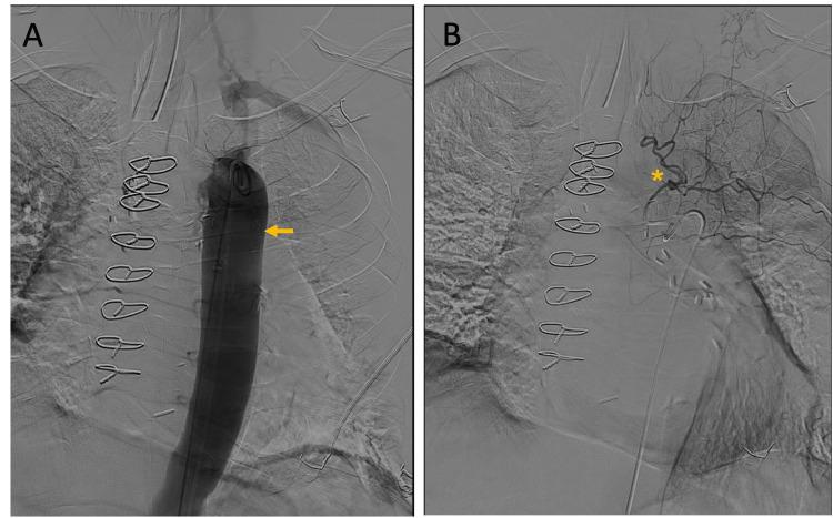 https://cdn.ncbi.nlm.nih.gov/pmc/blobs/8c9c/10351746/b9d9a7c56191/cureus-0015-00000042031-i03.jpg