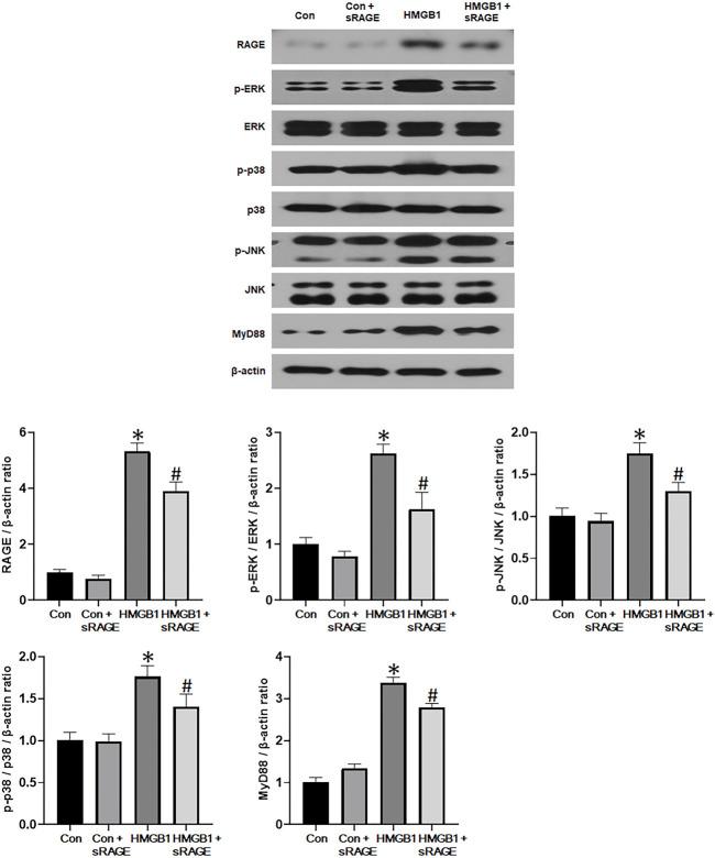 https://cdn.ncbi.nlm.nih.gov/pmc/blobs/8c9d/10227196/795872ec138e/fphar-14-1172269-g007.jpg