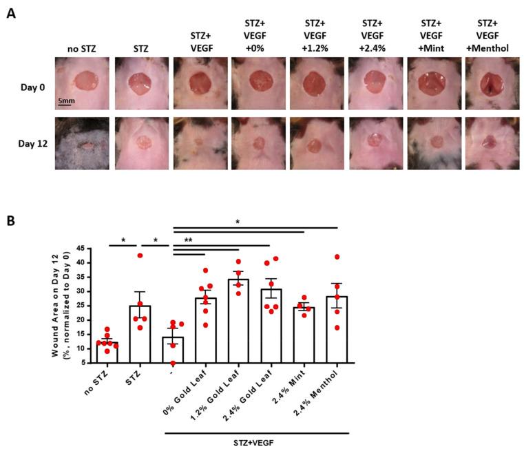 https://cdn.ncbi.nlm.nih.gov/pmc/blobs/8ca6/9137638/a1e17f3be014/antioxidants-11-00904-g005.jpg