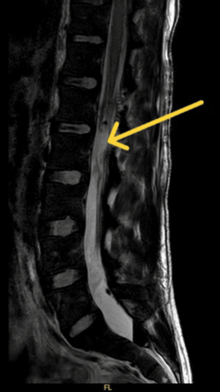https://cdn.ncbi.nlm.nih.gov/pmc/blobs/8cb0/11447257/e72ce8749674/cureus-0016-00000068490-i02.jpg