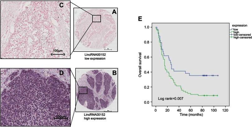 https://cdn.ncbi.nlm.nih.gov/pmc/blobs/8cb2/6535442/33573ea72ce4/CMAR-11-4643-g0002.jpg