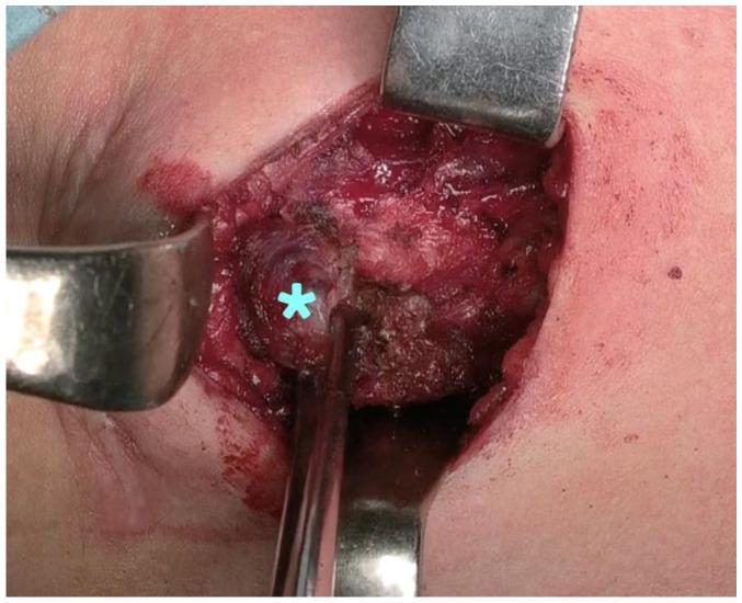 https://cdn.ncbi.nlm.nih.gov/pmc/blobs/8cb5/10095458/95ae87b95427/jcm-12-02492-g003.jpg
