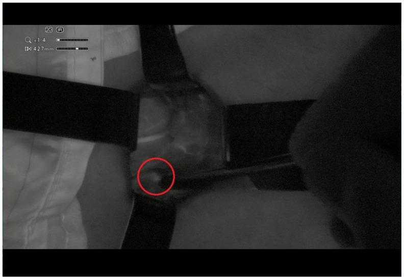 https://cdn.ncbi.nlm.nih.gov/pmc/blobs/8cb5/10095458/ffb6ec548749/jcm-12-02492-g004.jpg
