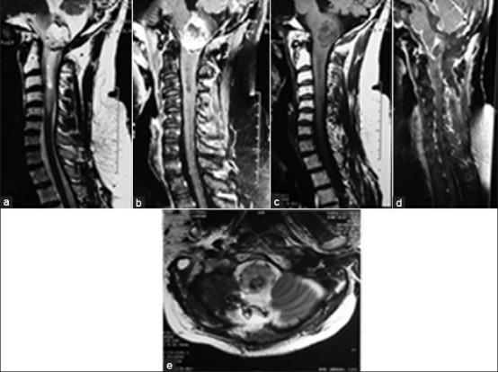 https://cdn.ncbi.nlm.nih.gov/pmc/blobs/8cbc/4038861/c063537dee2d/AJNS-9-21-g010.jpg