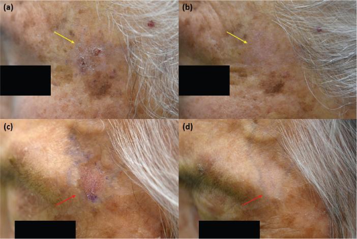 https://cdn.ncbi.nlm.nih.gov/pmc/blobs/8cbe/10108618/2f4a4b7b0682/ActaDV-103-5313-g001.jpg