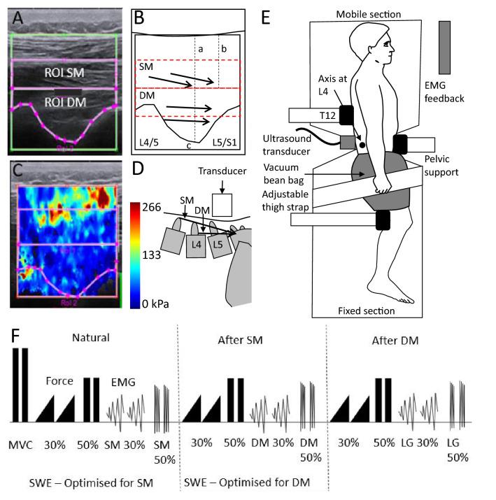 https://cdn.ncbi.nlm.nih.gov/pmc/blobs/8cbf/10460738/2a22fa765115/421_2023_5193_Fig1_HTML.jpg