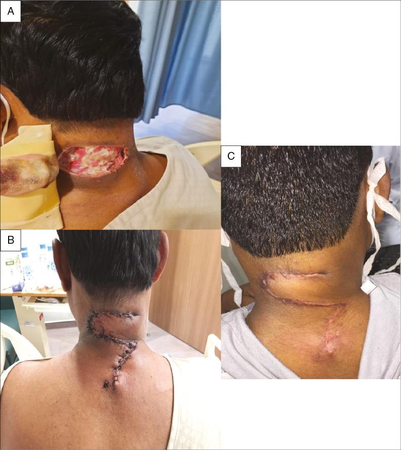 https://cdn.ncbi.nlm.nih.gov/pmc/blobs/8cc5/9364447/390a48060a23/JCAS-15-142-g003.jpg