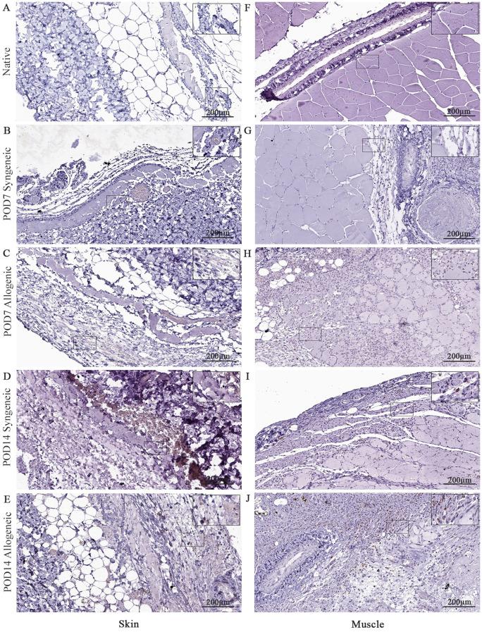 https://cdn.ncbi.nlm.nih.gov/pmc/blobs/8cc8/12213382/46d30cee5edd/fimmu-16-1595319-g010.jpg