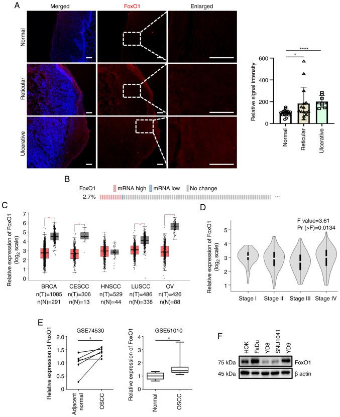 https://cdn.ncbi.nlm.nih.gov/pmc/blobs/8ccf/10173376/1eff16637e57/or-49-06-08559-g00.jpg