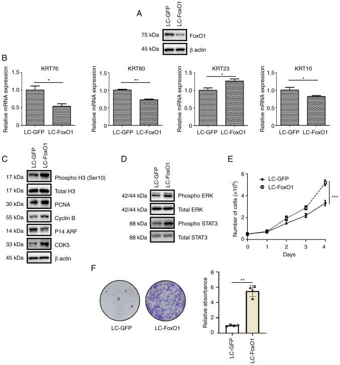 https://cdn.ncbi.nlm.nih.gov/pmc/blobs/8ccf/10173376/84a9a0592336/or-49-06-08559-g01.jpg
