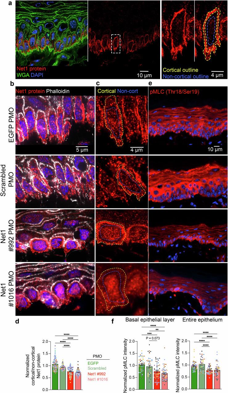https://cdn.ncbi.nlm.nih.gov/pmc/blobs/8cd2/12141530/0f0079081e4e/41467_2025_60532_Fig4_HTML.jpg