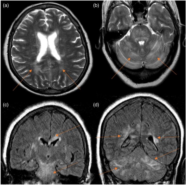 https://cdn.ncbi.nlm.nih.gov/pmc/blobs/8cd6/8493320/4aa04648e6c6/10.1177_20584601211038721-fig2.jpg
