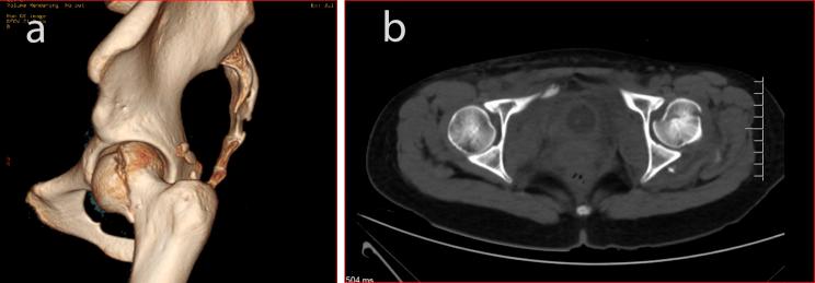 https://cdn.ncbi.nlm.nih.gov/pmc/blobs/8cd8/11792381/bd7ed7682306/12891_2025_8380_Fig1_HTML.jpg