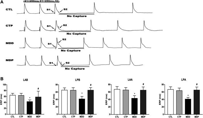 https://cdn.ncbi.nlm.nih.gov/pmc/blobs/8cd8/7775674/ba1310506f25/fphar-11-547966-g003.jpg