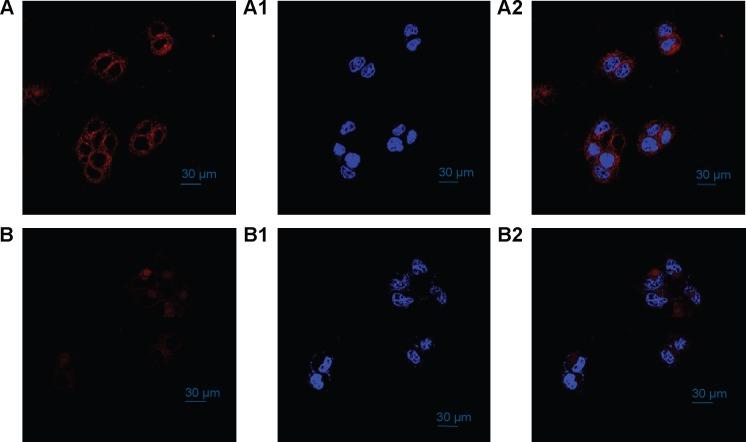 https://cdn.ncbi.nlm.nih.gov/pmc/blobs/8cd9/4445873/a24af07d5687/ijn-10-3623Fig11.jpg