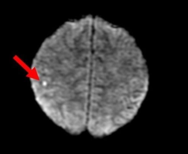 https://cdn.ncbi.nlm.nih.gov/pmc/blobs/8cdb/12170225/fddb8049c525/CCR3-13-e70565-g002.jpg