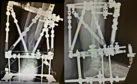 https://cdn.ncbi.nlm.nih.gov/pmc/blobs/8cdf/10337845/6ac9f3190107/oi9-6-e245-g001.jpg