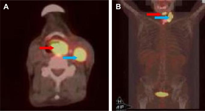 https://cdn.ncbi.nlm.nih.gov/pmc/blobs/8cdf/6398402/0e104f4f88bc/ott-12-1593Fig3.jpg