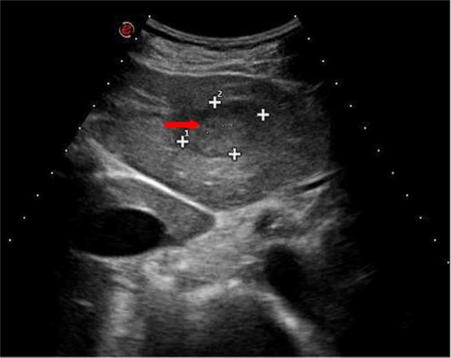https://cdn.ncbi.nlm.nih.gov/pmc/blobs/8cdf/6398402/144f2fcf07fe/ott-12-1593Fig8.jpg