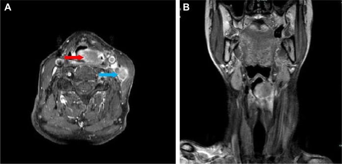 https://cdn.ncbi.nlm.nih.gov/pmc/blobs/8cdf/6398402/290dbf59305f/ott-12-1593Fig2.jpg