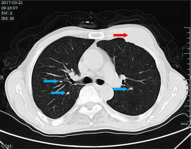 https://cdn.ncbi.nlm.nih.gov/pmc/blobs/8cdf/6398402/3e5badb8f283/ott-12-1593Fig7.jpg