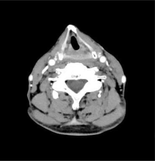 https://cdn.ncbi.nlm.nih.gov/pmc/blobs/8cdf/6398402/538656b93f37/ott-12-1593Fig6.jpg