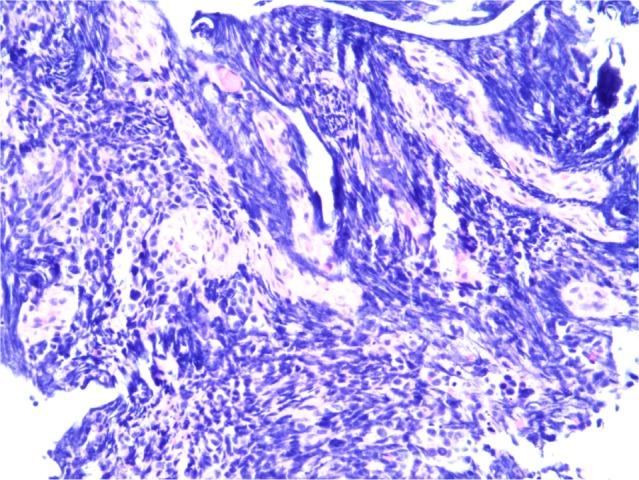 https://cdn.ncbi.nlm.nih.gov/pmc/blobs/8cdf/6398402/72fca5c2ad9c/ott-12-1593Fig4.jpg