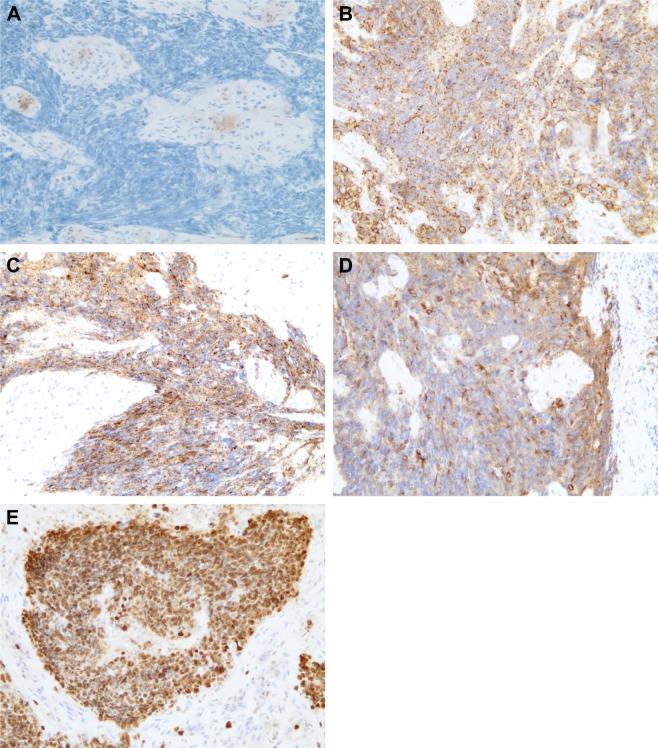 https://cdn.ncbi.nlm.nih.gov/pmc/blobs/8cdf/6398402/863ca75bbe1f/ott-12-1593Fig5.jpg