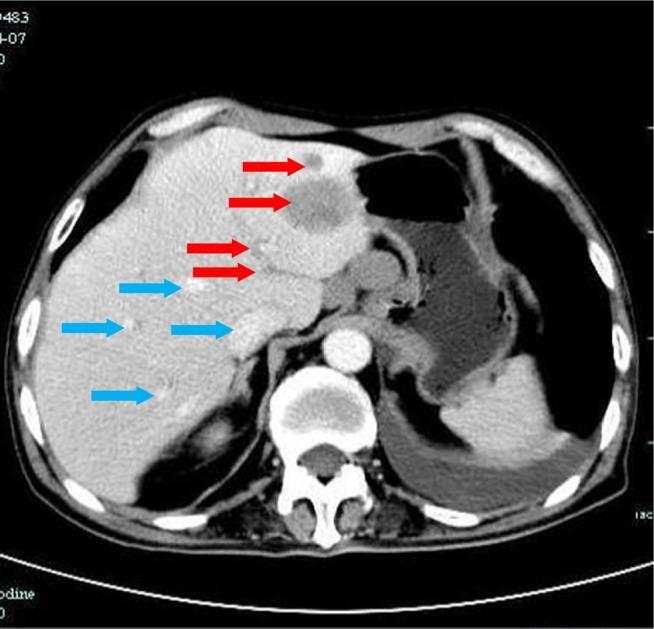 https://cdn.ncbi.nlm.nih.gov/pmc/blobs/8cdf/6398402/fa485981dca9/ott-12-1593Fig10.jpg