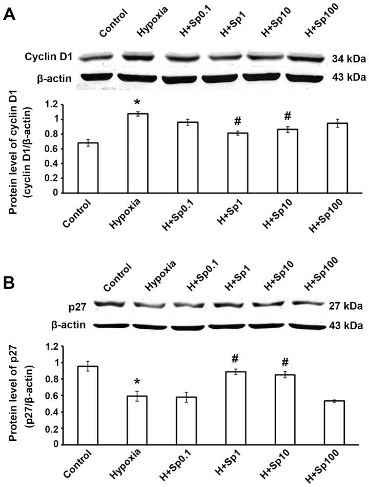 https://cdn.ncbi.nlm.nih.gov/pmc/blobs/8ce7/4687431/67bea6c47f3d/IJMM-37-01-0039-g04.jpg