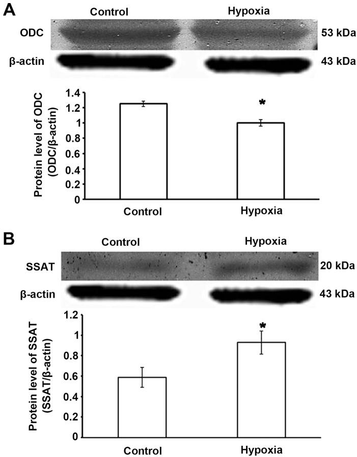 https://cdn.ncbi.nlm.nih.gov/pmc/blobs/8ce7/4687431/81c4b968f3a3/IJMM-37-01-0039-g01.jpg