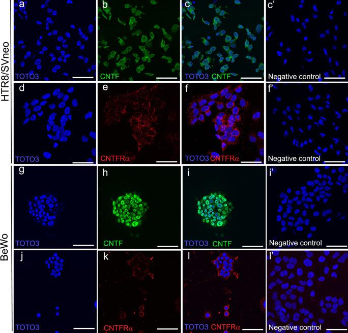https://cdn.ncbi.nlm.nih.gov/pmc/blobs/8ce9/9525382/f28cc4c1d126/441_2022_3658_Fig3_HTML.jpg