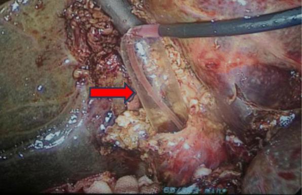 https://cdn.ncbi.nlm.nih.gov/pmc/blobs/8cf3/7079474/ba1c427a5360/12893_2020_705_Fig3_HTML.jpg