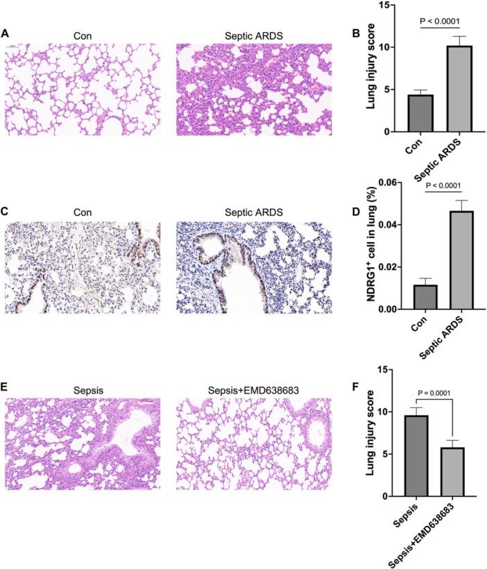https://cdn.ncbi.nlm.nih.gov/pmc/blobs/8cf7/11760491/577d2160fd64/IID3-13-e70136-g008.jpg