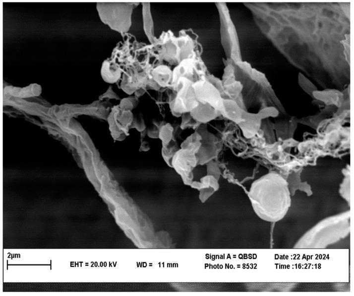 https://cdn.ncbi.nlm.nih.gov/pmc/blobs/8cfc/11435210/86738291bec7/pathogens-13-00790-g004.jpg