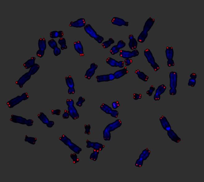 https://cdn.ncbi.nlm.nih.gov/pmc/blobs/8d04/3935097/a5c7813f90e0/114_2014_1152_Fig3_HTML.jpg