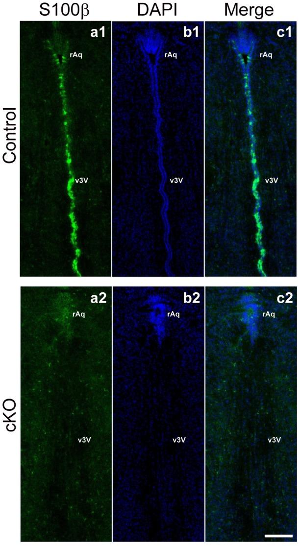 https://cdn.ncbi.nlm.nih.gov/pmc/blobs/8d05/3827428/45098b95a797/pone.0080356.g003.jpg
