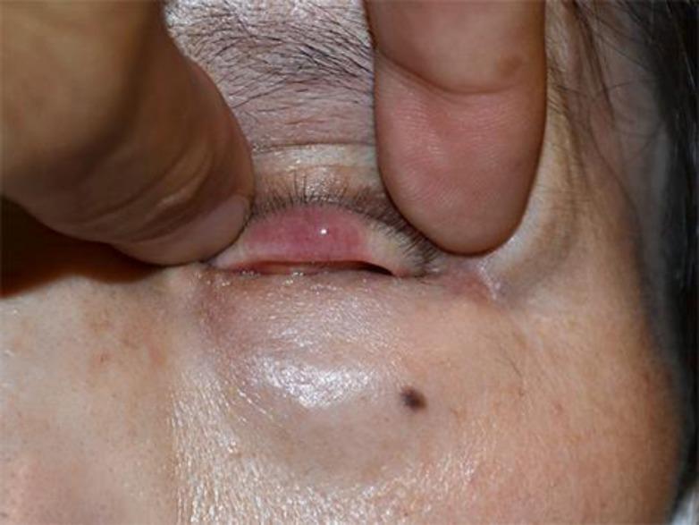 https://cdn.ncbi.nlm.nih.gov/pmc/blobs/8d05/4748776/ef97a15c1544/cop-0007-0025-g01.jpg